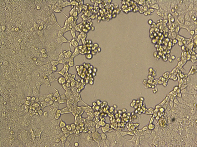 早期出现病变的vero-E6传代细胞