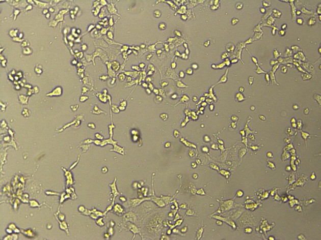 出现完全病变的vero-E6传代细胞