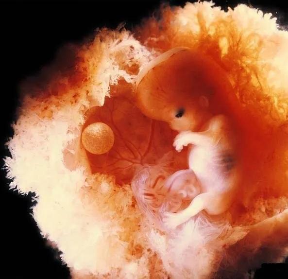孕十二周真实胎儿图图片