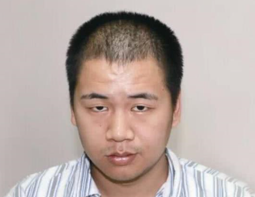 男孩子晨起若有"3表现",八成肾脏已"受损",出现一个也要及时就医!