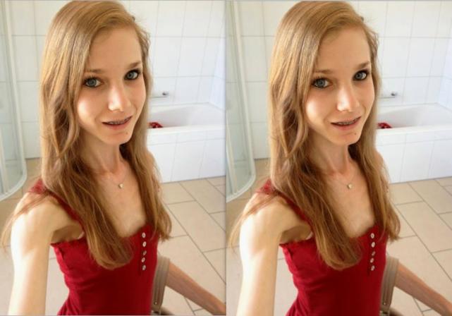 还记得那位60斤骨瘦如柴的女孩?看到她的现状,网友:羡慕了