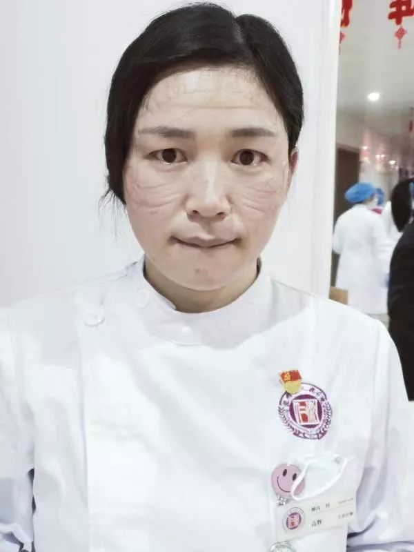 满脸勒痕,这是最美的护士脸