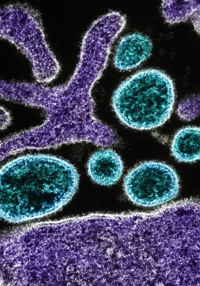 ▼蓝色圆形为尼帕病毒,紫色为被感染的vero e6细胞;透射电子显微镜