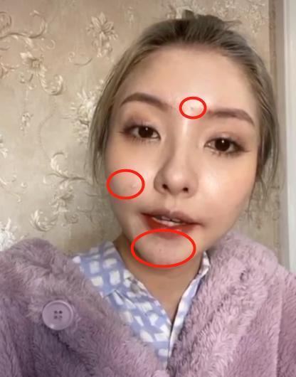 颜值崩了王思聪前女友脸部浮肿被疑填充过度不复当年清纯模样