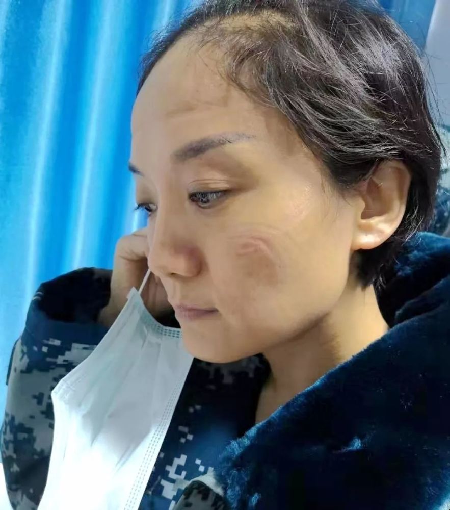 口罩和护目镜脱下穿了一天的防护服空军军医大学医疗队队员郭玮武昌