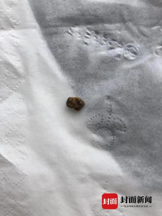 穿防护服不喝水肾结石发作 江苏援鄂医生忍痛坚持在"疫"线