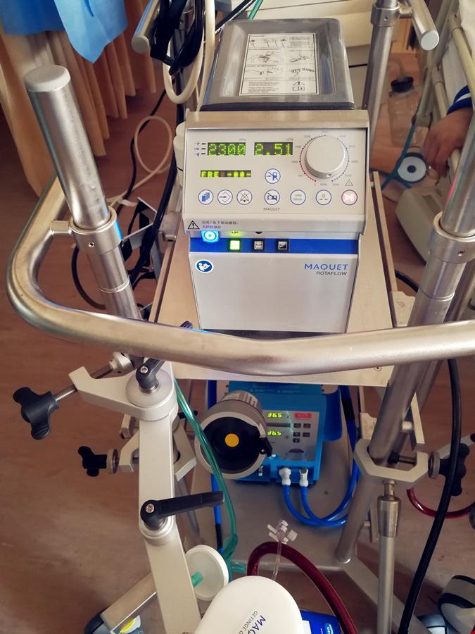 科普:"救命神器"ecmo到底是什么?