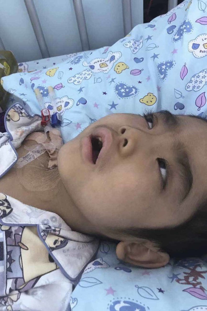 广东一5岁男孩患重症3进icu,当家人想要放弃时他摇了摇头_腾讯新闻