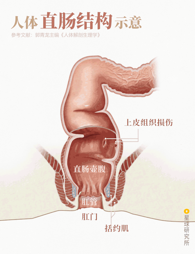 ▼(人体直肠结构示意,制图@郑伯容/星球研究所)需要警惕艾滋病传播的