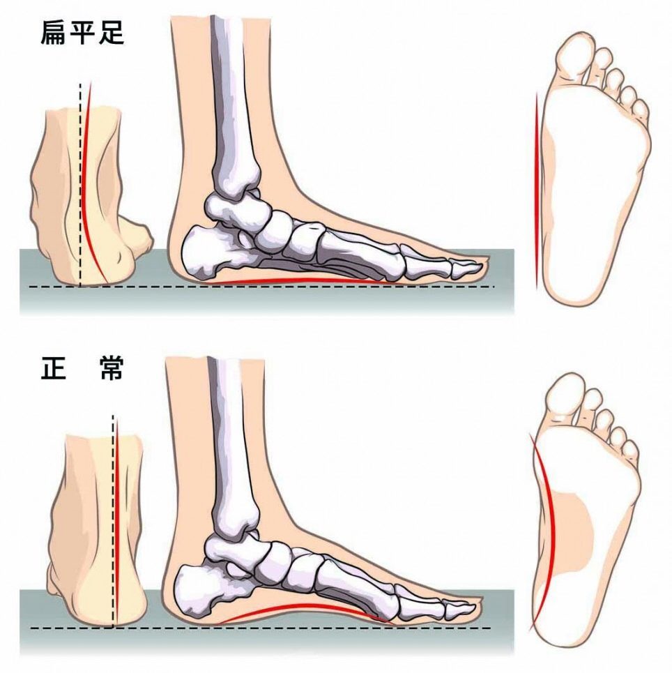 心疼 这样伤害健康的事情 女人们却天天都在做 腾讯新闻