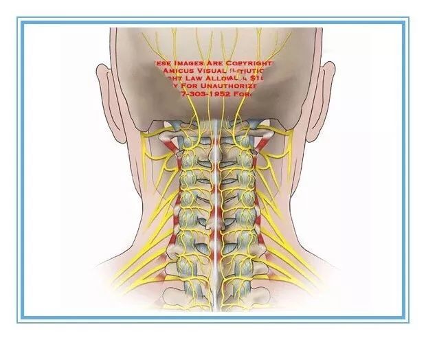 不要等到中风了才知道自己患有颈椎病