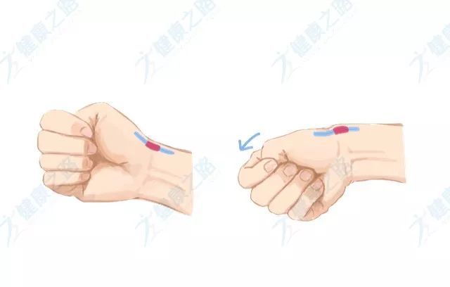 這個手勢做不了,你可能得了腱鞘炎!每天5分鐘4個小動作,徹底擺脫它!