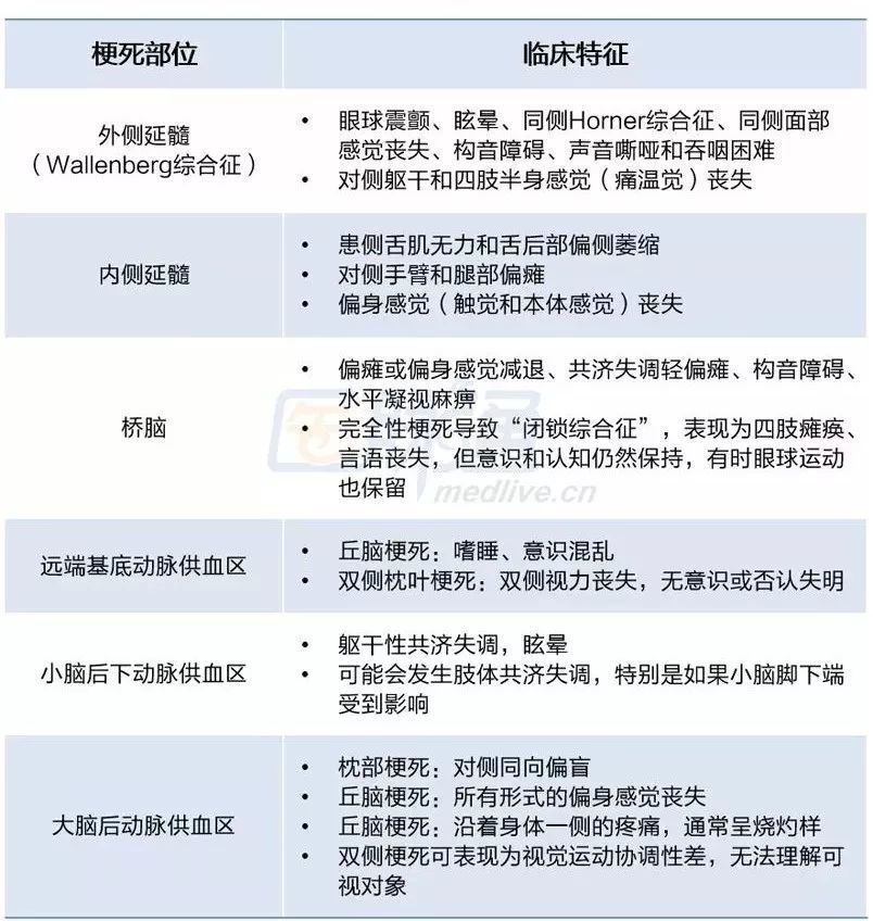 后循环卒中综合征的临床特点 腾讯新闻