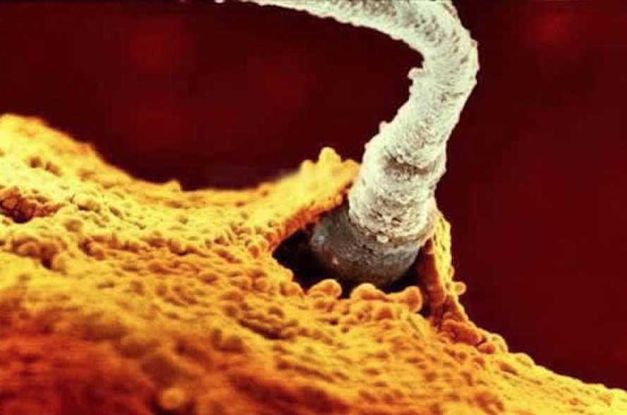 20张高清照片,记录胎儿发育全过程,让人感叹生命神奇,母爱伟大