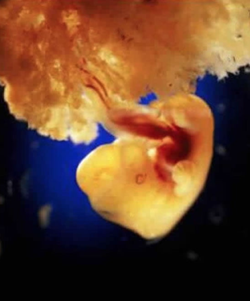20张高清照片,记录胎儿发育全过程,让人感叹生命神奇,母爱伟大