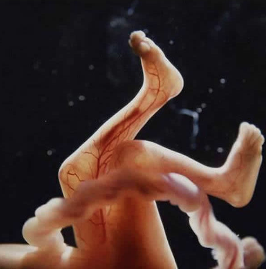 孕二十七周胎儿真实图图片