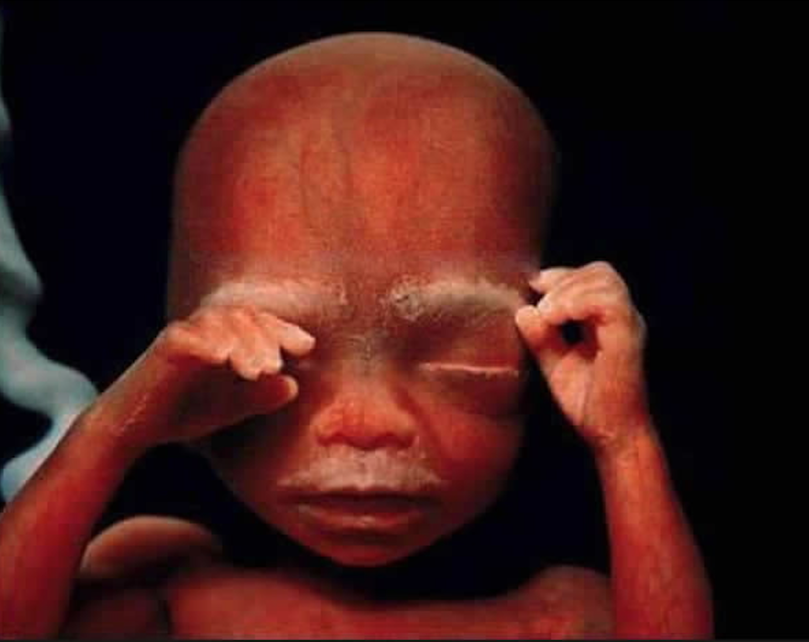 胎儿照片真人图片