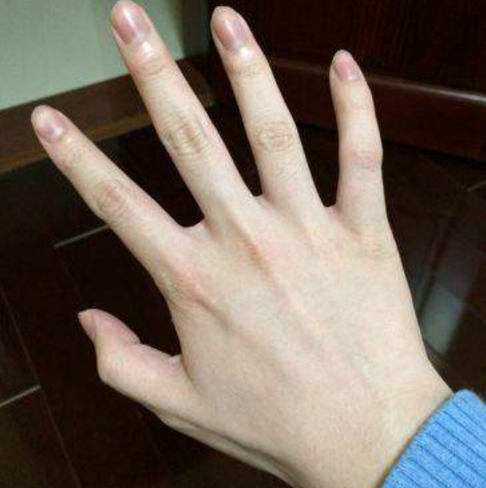 肾脏"有力"的男生,手上有这"3个标志",只占一个也值得恭喜