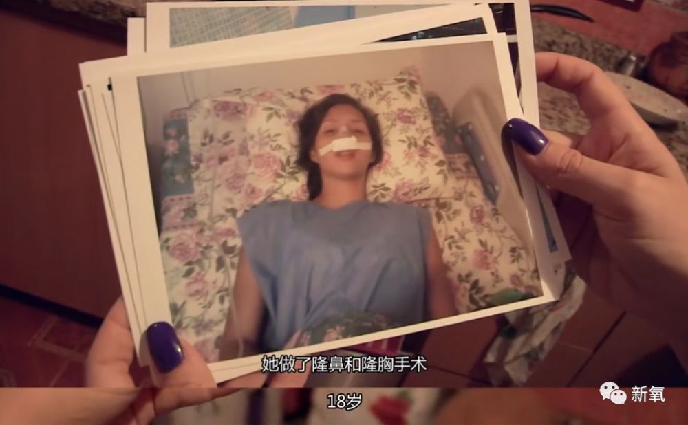 未成年整形、在舌头上缝塑料网，为了选美究竟可以多么疯狂？（组图） - 17