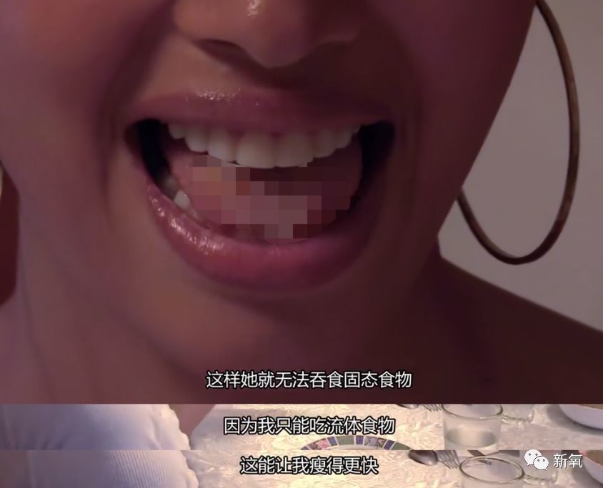 未成年整形、在舌头上缝塑料网，为了选美究竟可以多么疯狂？（组图） - 21
