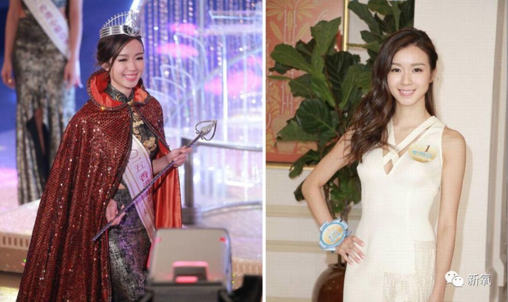 未成年整形、在舌头上缝塑料网，为了选美究竟可以多么疯狂？（组图） - 43