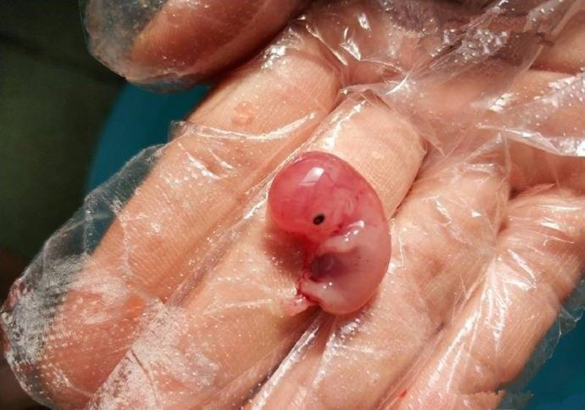 9周胚胎排出来的图片图片