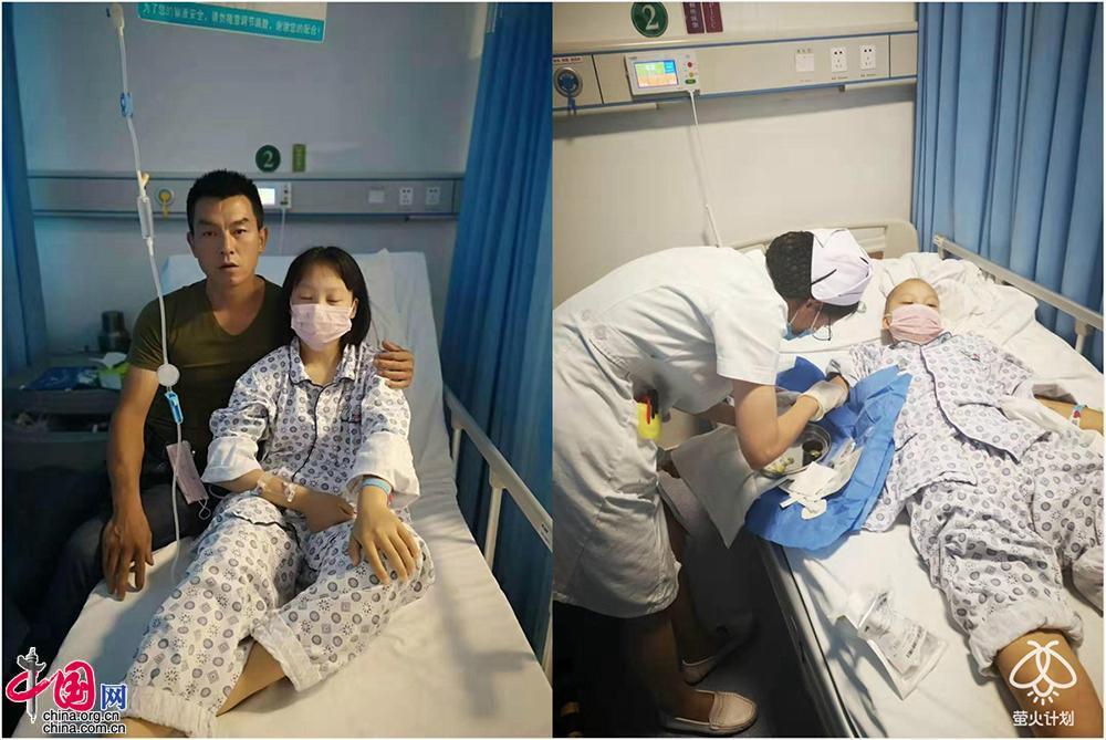 封城前父亲连夜赶回武汉重病女儿看见他哭了爸好怕你回不来