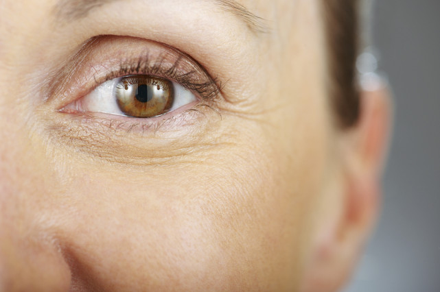 小细纹和表情纹有什么不同?皱纹的分类和形成原因