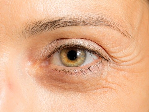 小细纹和表情纹有什么不同?皱纹的分类和形成原因