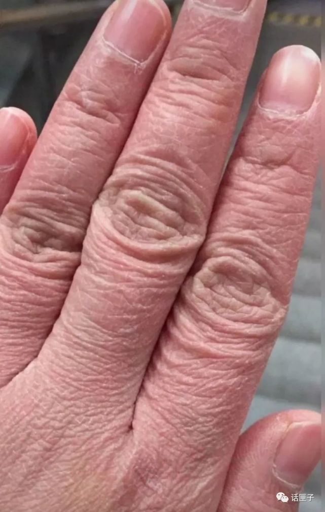 这只被寒风吹裂的手你能猜到是谁的吗为年轻的力量点赞