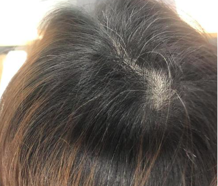 为什么有的人到40岁左右还能保持一头乌黑发亮的头发