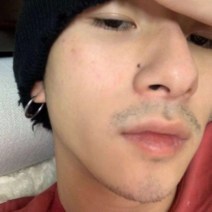 雄激素过低的男孩子八成身上会有这3特征希望你一个不占