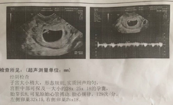 胎囊图片 椭圆图片