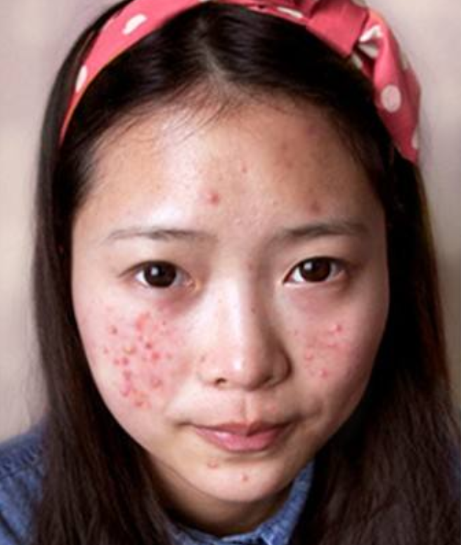 初中生停止发育的3信号若你全收到身高八成已定格