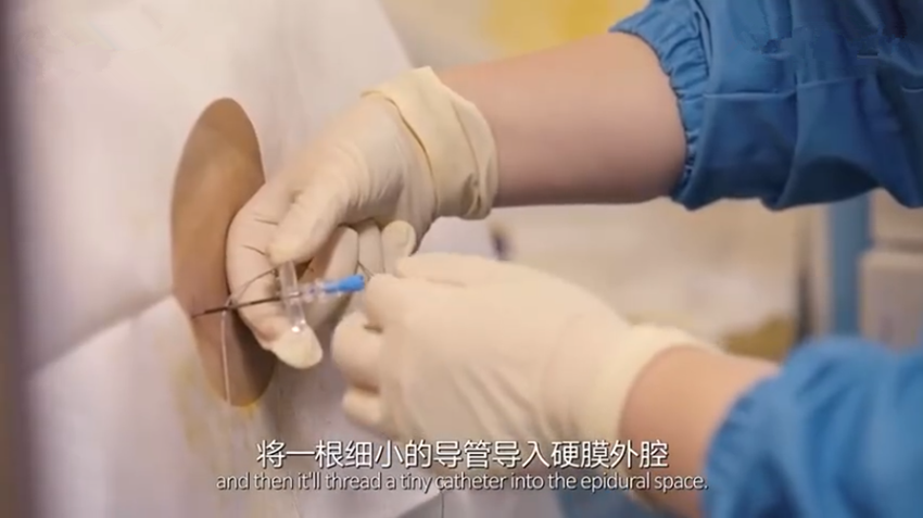 无痛针到底怎么打?组图揭秘全过程:每看一次都会觉得腰酸一次!
