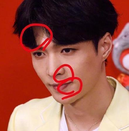 张艺兴彩排受伤表演后空翻脸着地摔伤膝盖坚持排练很敬业