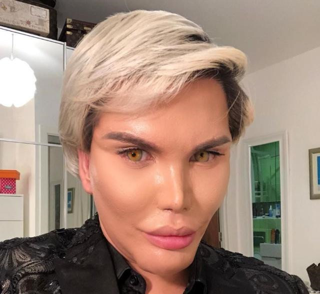 全球整容最"疯狂"的男子,全身除了脑子,全部地方都整了容