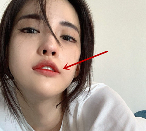 因为潘南奎做了嘴角上扬的手术,所以说她的嘴唇看上去一直都是上扬的