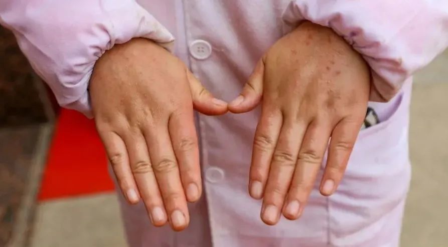 一个90后的柘城姑娘,却长了一双"50岁"的手!