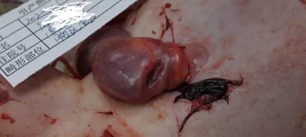 孕 1 产 1 孕 30 2 周顺产单死胎.