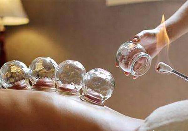 拔罐颜色越深提示湿气越重医生良言三种人拔罐是自讨苦吃