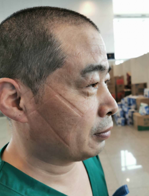 点赞援鄂医生刘力新再显退役军人风采