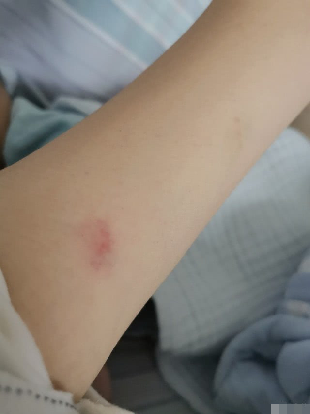 李艾胳膊被9个月儿子咬伤,灯泡露出五颗小牙齿憨笑,太招人喜欢