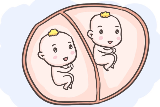双胞胎|胎儿|绒毛膜|双胎|胎盘