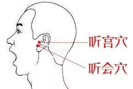 听会者即耳能听闻声音也,此指穴内的天部气血为