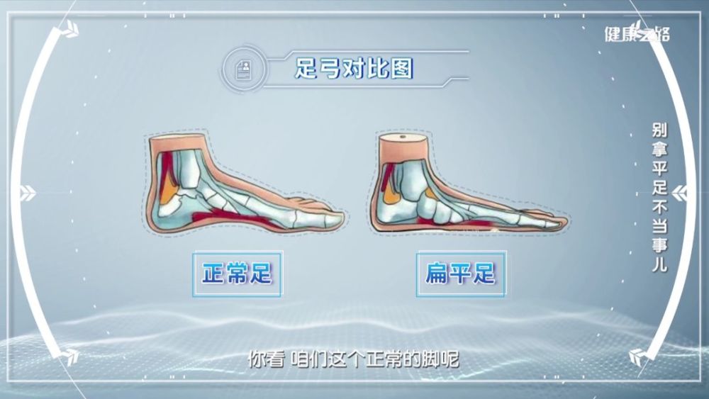 腰疼找不到原因 可能是脚惹的祸 腾讯新闻