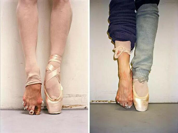 芭蕾舞者的脚变形图片