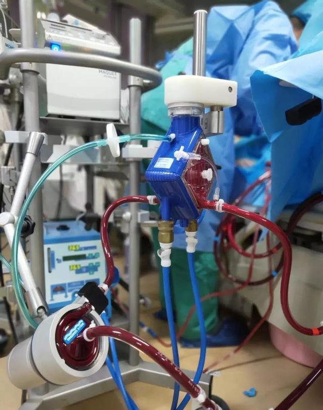 在这次新冠疫情中发挥了巨大作用的ecmo是什么?它有什么作用呢?