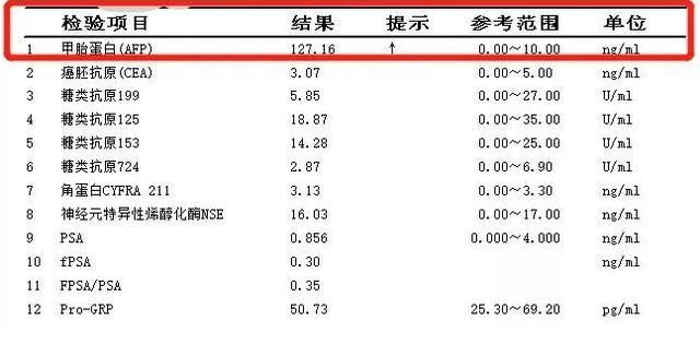 甲胎蛋白偏高图片