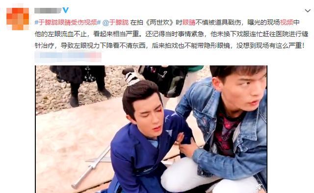 于朦胧剧组受伤视频曝光,左眼被戳流血不止,曾拍戏摔伤五处骨折